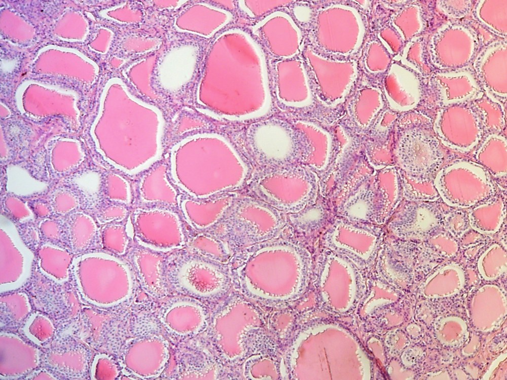 甲状腺の組織像（HE染色）。大小さまざまな丸い濾胞が並び、内部がピンク色のコロイドで満たされている