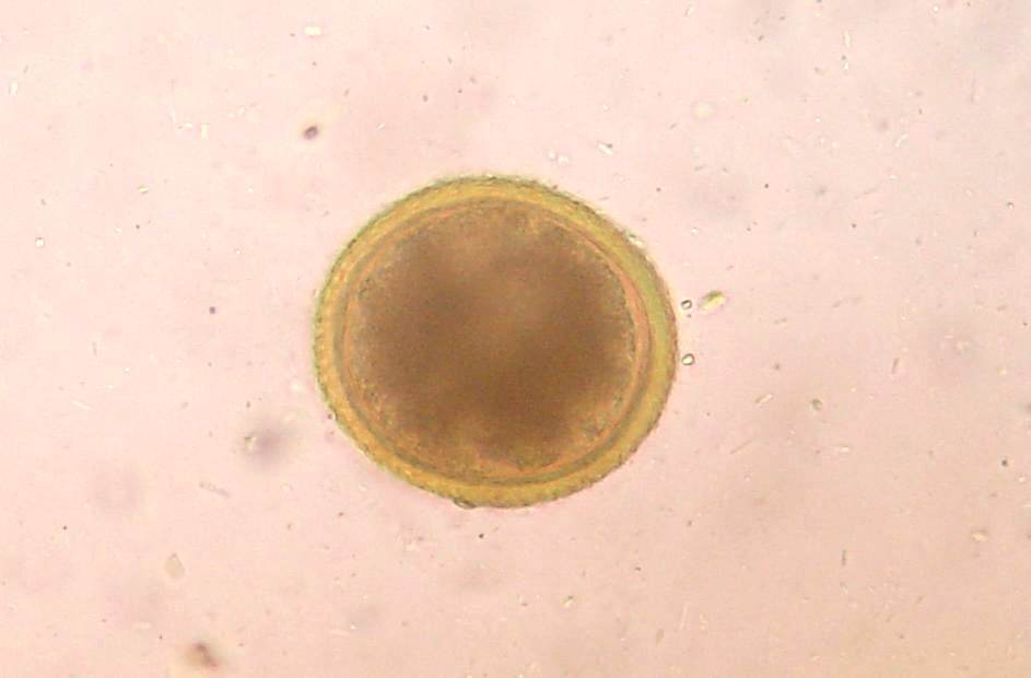犬回虫の虫卵。球形に近く厚い殻の表面に細かい凹凸がある顕微鏡写真