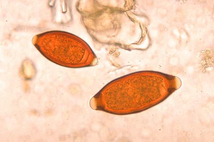 鞭虫の虫卵2個。レモン形で両端に無色の栓がある顕微鏡写真
